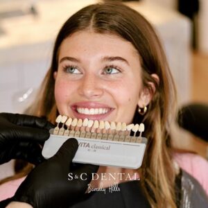 Patient with a Dental Veneer options at S&N Dental