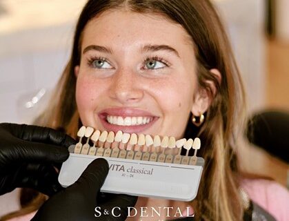 A Patient with a Dental Veneer options at S&N Dental in Scottsdale AZ.