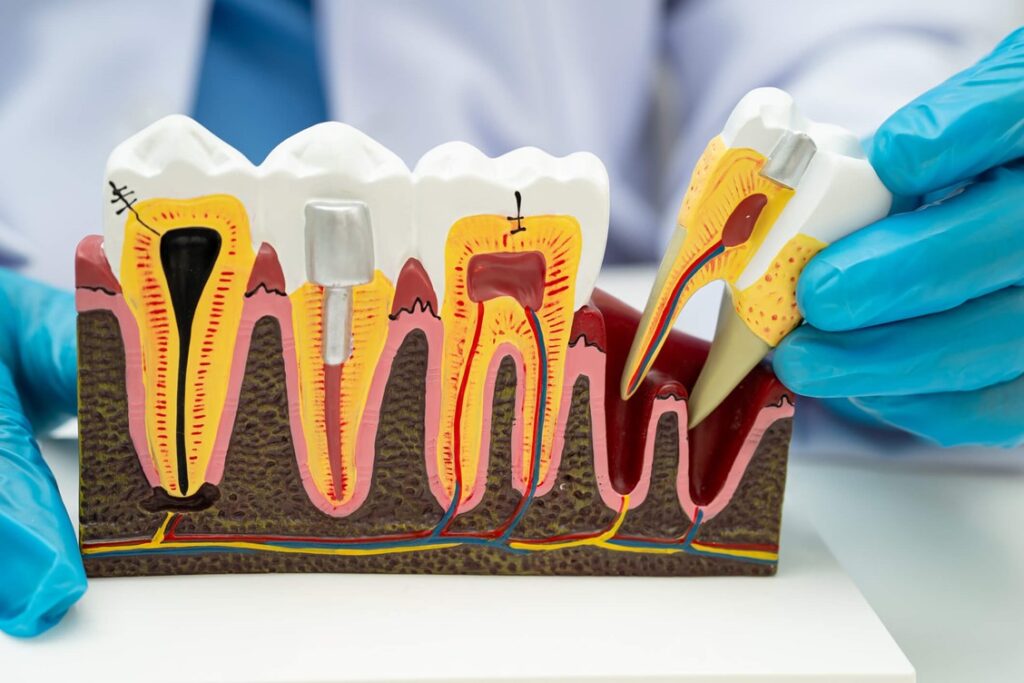 A close-up of a model of teeth
